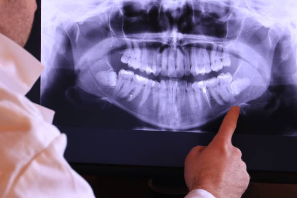 Best Emergency Dental Care for Trauma or Injury in North Patchogue, NY